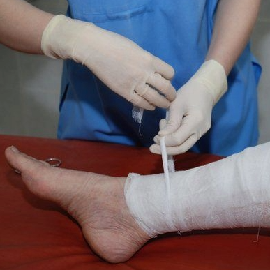 Productos químicos y sustancias a las que cualquier persona podría estar expuesta durante el tratamiento de las úlceras en las piernas. Sustancias con propiedades médicas, conservación y vehículos en la formulación.




Name
Conc


A 004
Amerchol L 101
50.0% pet


F 003
Fusidic acid sodium salt
2.0% pet


C 005
CHLORHEXIDINE DIGLUCONATE
0.5 aq


B 027
BENZALKONIUM CHLORIDE
0.1 aq


N 005
Nitrofurazone
1.0% pet


B 032A
Bacitracin
5.0% pet


C 033
CETEARYL ALCOHOL
20.0% pet


D 006
BHT
2.0% pet


C 032
Chloramphenicol
5.0% pet


B 007
Benzoylperoxide
1.0% pet


P 019A
PROPYLENE GLYCOL
5.0% pet


P 022
Propolis
10.0% pet


T 007
THIMEROSAL
0.1% pet


S 003
SORBIC ACID
2.0% pet


Mx 14
Wood tar mix
12.0% pet


C 008
p CHLORO m CRESOL
1.0% pet


B 033B
Budesonide
0.01% pet


T 016
TRIETHANOLAMINE
2.0% pet


F 005
Framycetin sulphate
20.0% pet


S 005
SORBITAN SESQUIOLEATE
20.0% pet


T 031B
Tixocortol 21 pivalate
0.1% pet


S 004
SORBITAN OLEATE
5.0% pet


P 008
PHENYL MERCURIC ACETATE
0.01 aq


C 006
CHLOROACETAMIDE
0.2% pet


D 044A
DIAZOLIDINYL UREA
2.0% pet


I 001A
IMIDAZOLIDINYL UREA
2.0% pet